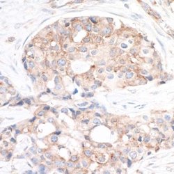 Ribosomal Protein S6/RPS6 Antibody, Novus Biologicals 0.1mL; Unlabeled:Antibodies,